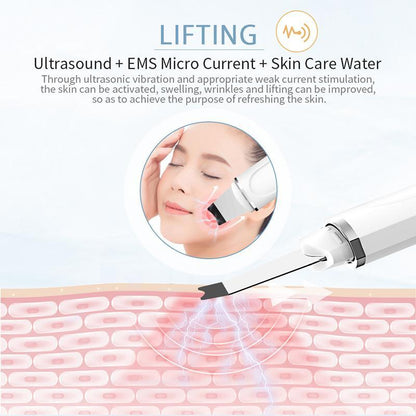 Ultrasonic Heating Skin Scrubber